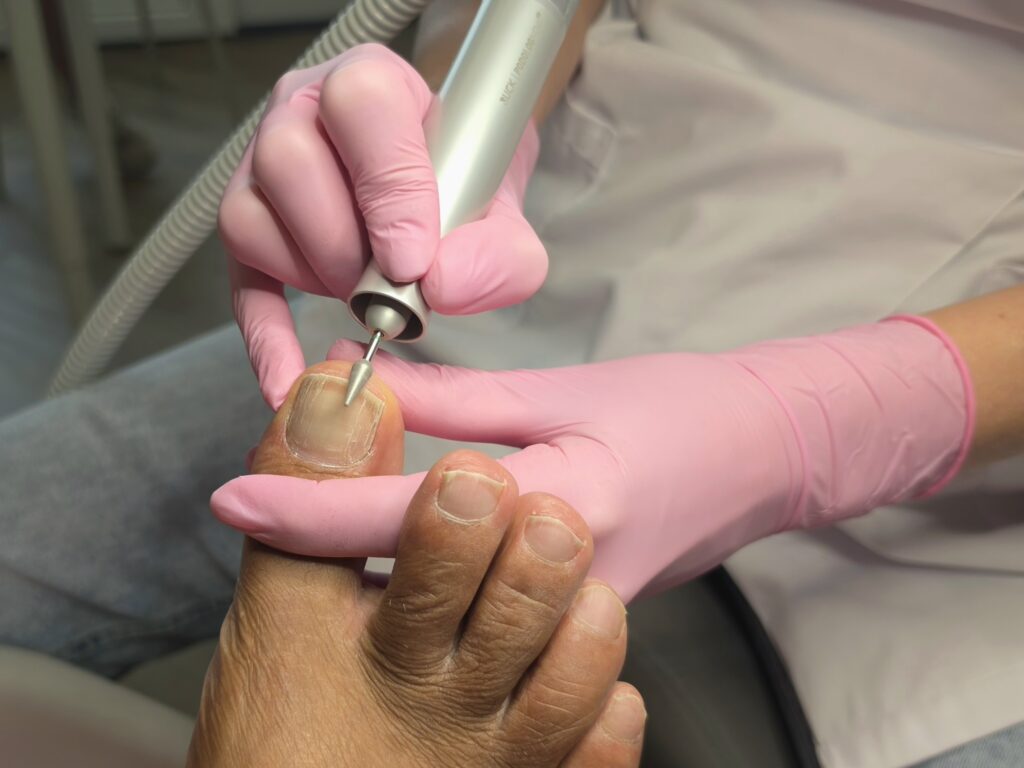 Pedicurebehandeling bij Footcare Eindhoven